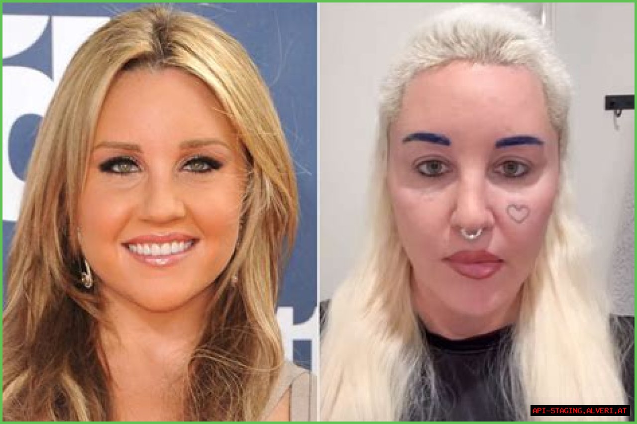 Shannon Elizabeth Plastic Surgery Before and After